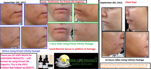 Banished™ Blemish Serum, 0.5 oz